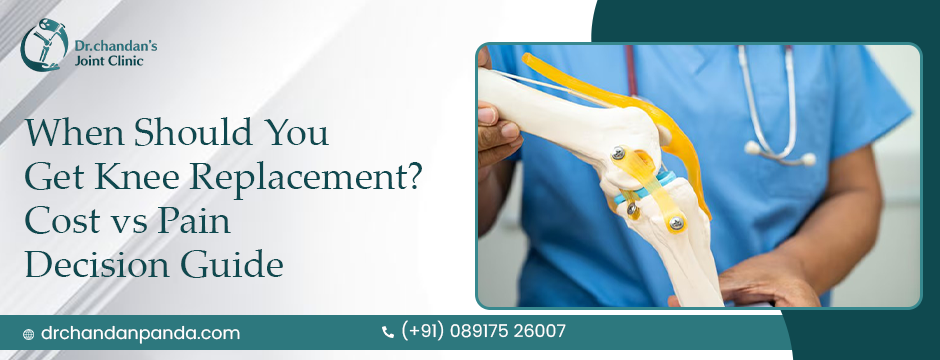 Knee-Replacement